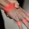 Treatment Options for Nerve Damage