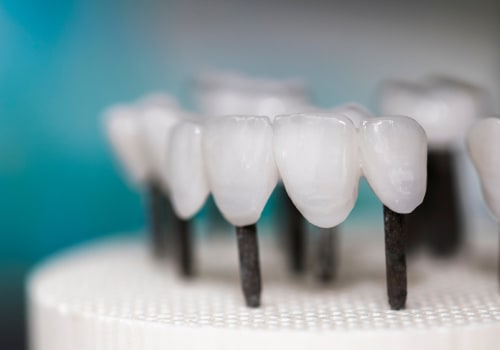 Potential Drawbacks of Zirconia Implants: What You Need to Know