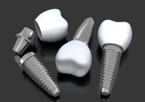 Understanding the Pros and Cons of Traditional Implants: A Comprehensive Guide to Alternative Options